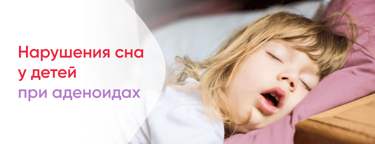 Нарушения сна у детей при аденоидах