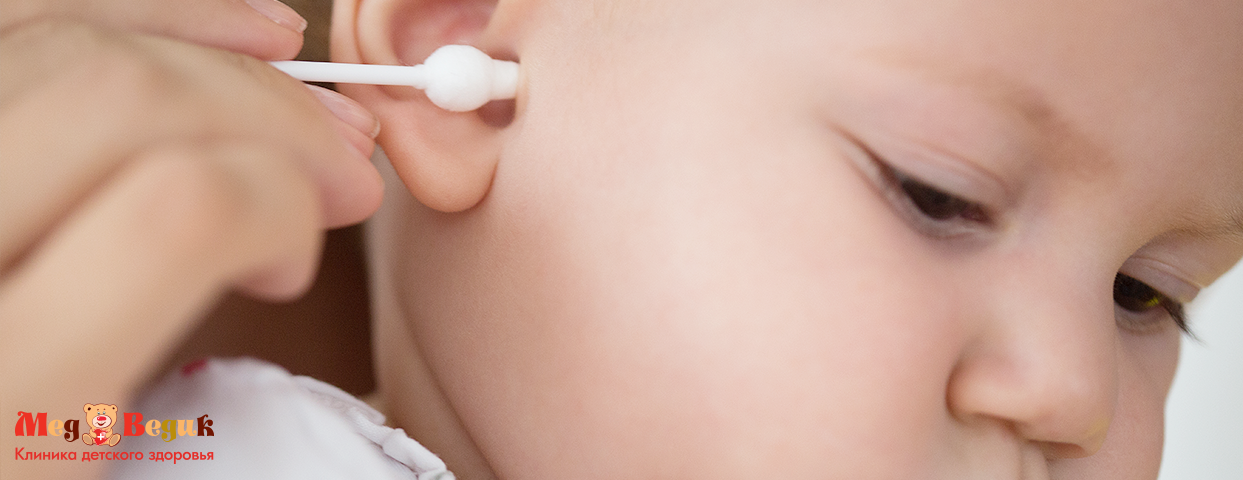Можно ли чистить детские уши ватными палочками?